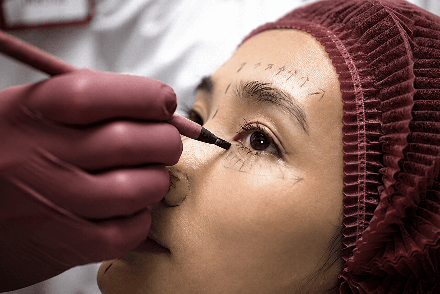 Oculoplasty Assessment