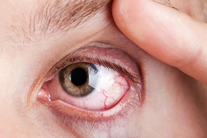 Specialized Retina Eye Care slide 2