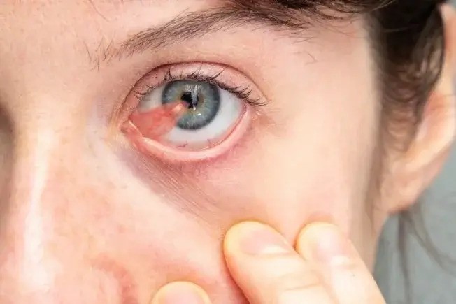 Specialized Retina Eye Care slide 3