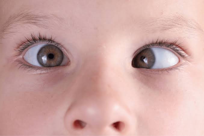 Pediatric Eye Care slide 1